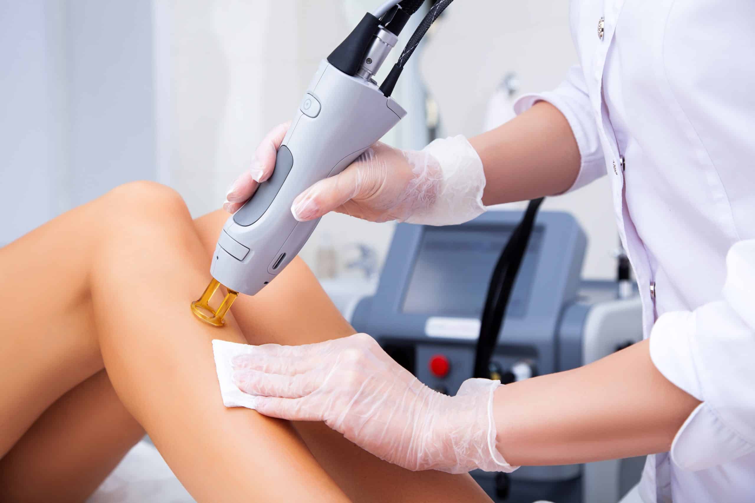 What to Expect During a Laser Hair Removal Treatment A Step-by-Step Guide