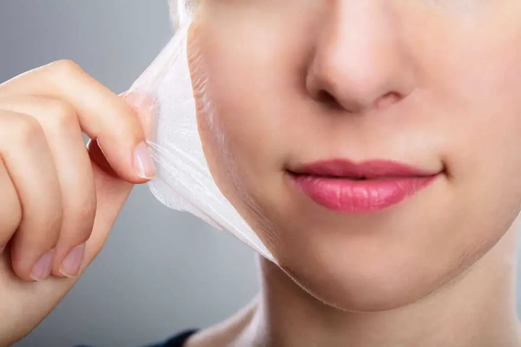 How many days does a chemical peel last? 3 Chemical peels by Health and wellness spa in Charlottesville, VA