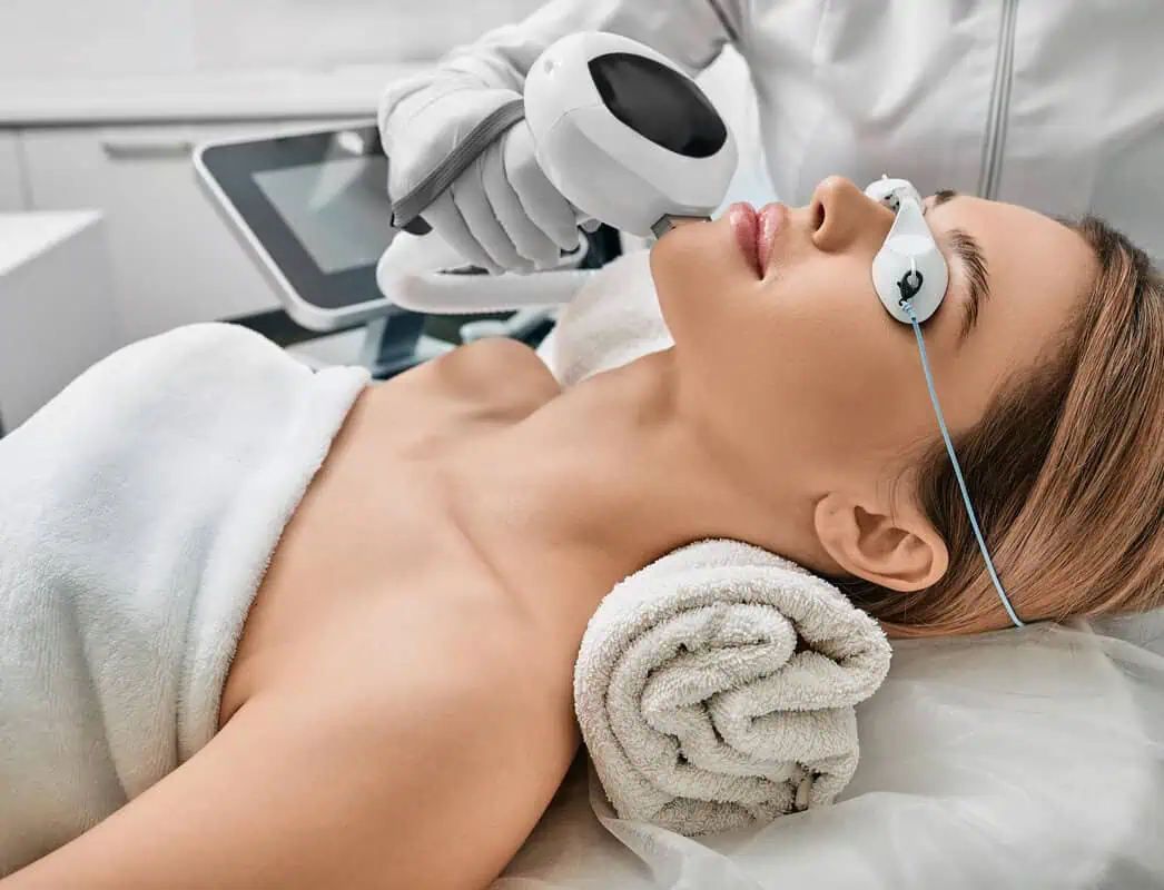 IPL Skin Rejuvenation Charlottesville VA