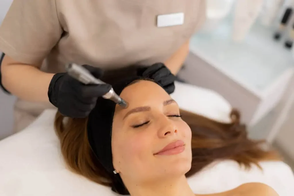 Scarlet SRF Microneedling for Stretch Marks: A Treatment for Smooth Skin 1 Scarlet SRF Microneedling in Charlottesville, VA at Health and wellness spa
