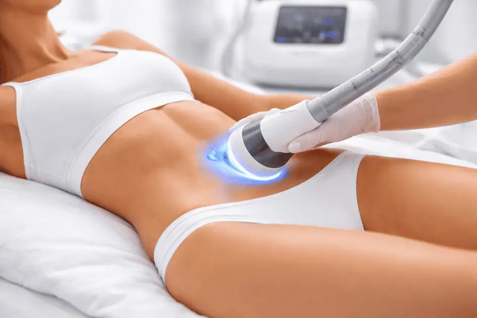 CryoSkin body contouring treatment on abdomen for fat reduction