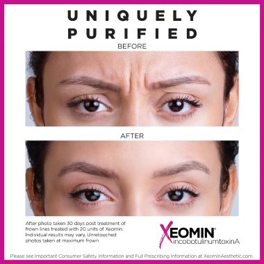 Before & After Image Of Xeomin Treatment In Charlottesville, VA By Health & Wellness Spa