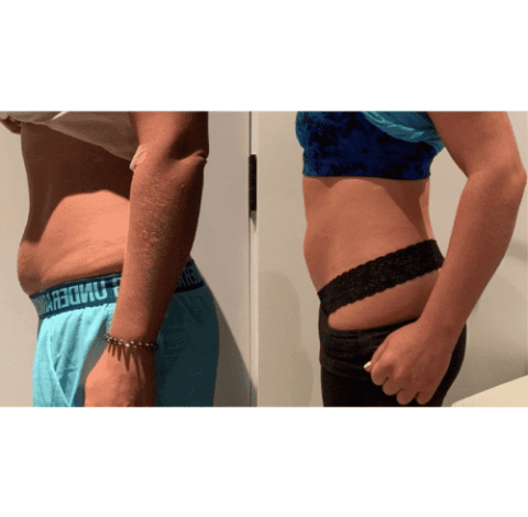 Slimming Treatment By Charlottesville, VA In Health & Wellness Spa