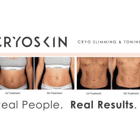 Cryo Slimming Treatment By Charlottesville, VA In Health & Wellness Spa