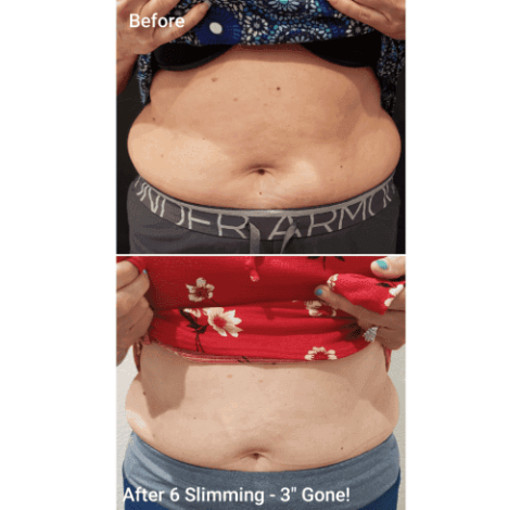 Slimming Treatment By Charlottesville, VA In Health & Wellness Spa