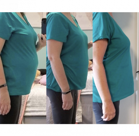 Before and After Pictures 11 Slimming Treatment By Charlottesville, VA In Health & Wellness Spa