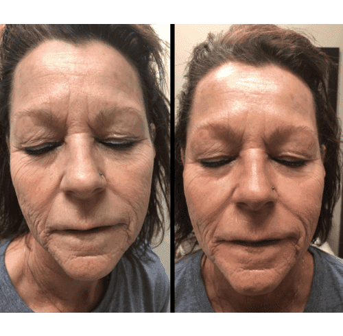 Facial Treatment Charlottesville, VA In Health & Wellness Spa