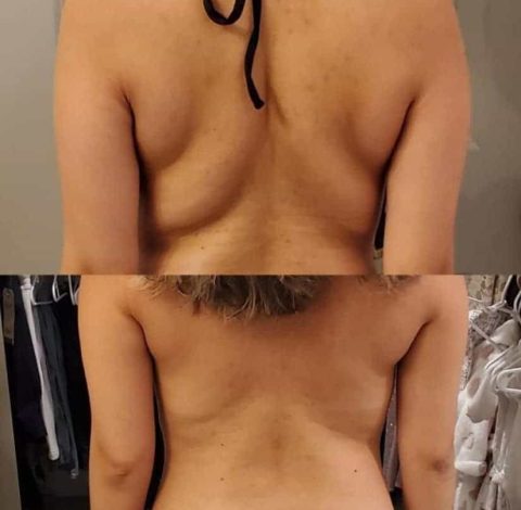 Before and after back view, showing reduced back fat.